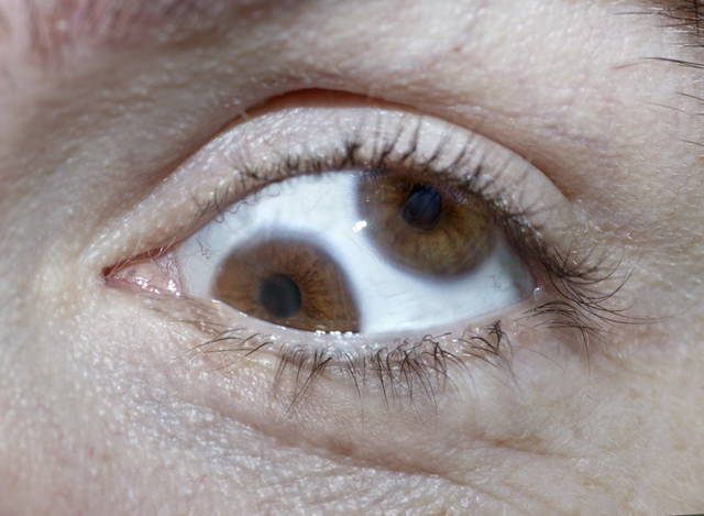 Double vision eyeball